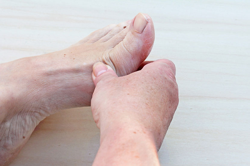 What Causes Ganglion Cyst On Bottom Of Foot