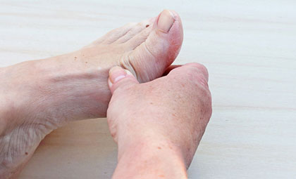Ganglion-Cysts-Los-Angeles-Foot-and-Ankle-Surgeon-1-1
