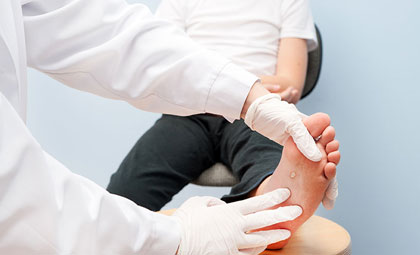 Pressure-Ulcers-Los-Angeles-Foot-and-Ankle-Surgeon-1-1