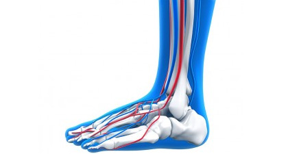 Accessory Navicular Syndrome  Foot & Ankle Specialty Group