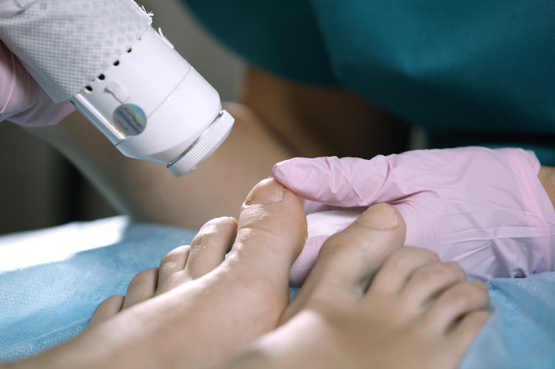 Studio City Podiatrist - Los Angeles Foot and Ankle Surgeon-4