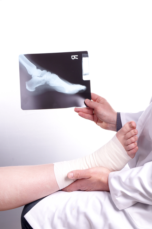 Neuroma Surgery in Studio City - Los Angeles Foot and Ankle Surgeon 1