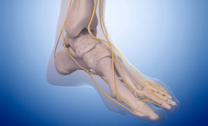 Peripheral Neuropathy - Foot & Ankle Institute of the West